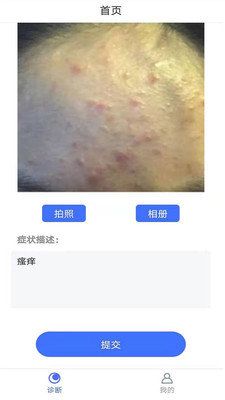 皮肤病拍照自测app图片