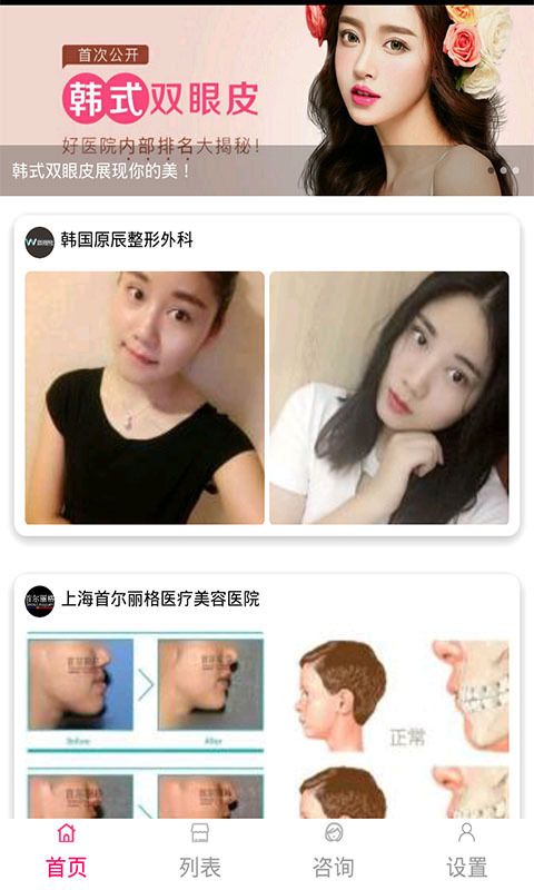 整形去哪儿_图片2