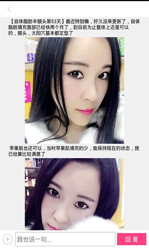 整形去哪儿_图片4