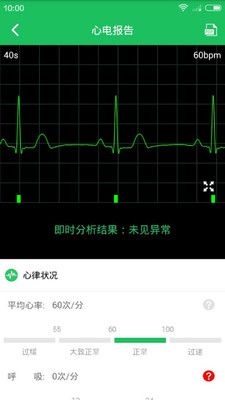极简心电监测仪_图片4