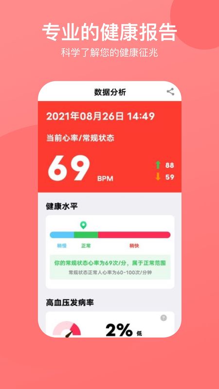 心率心电图_图片4