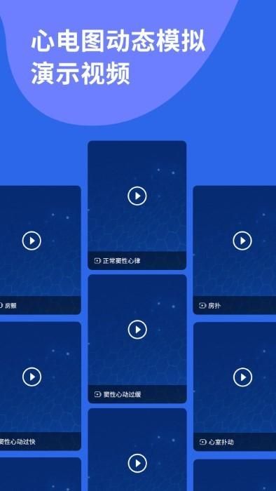 心电图ECG_图片5