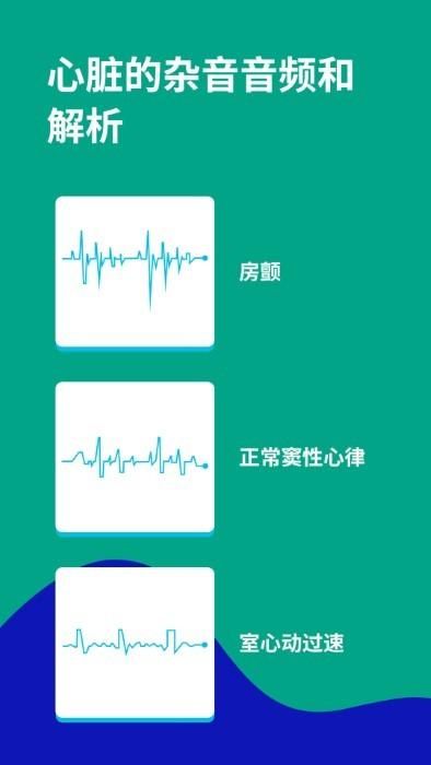 心电图ECG_图片2