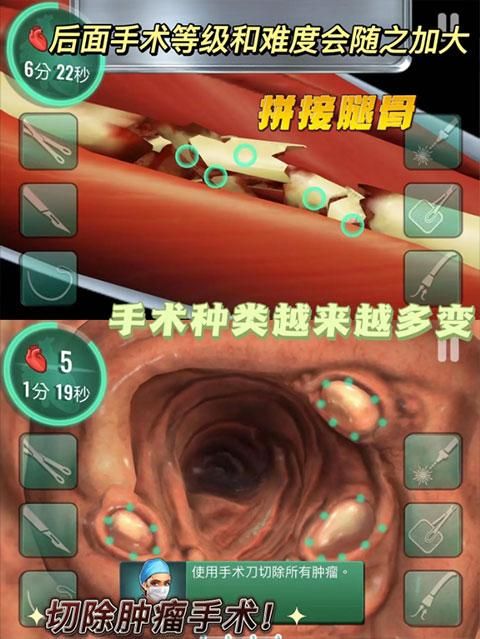 医院手术时间中文版_图片4