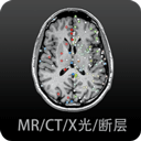 影像解剖图谱